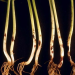 CollarRotRhizoctoniaSolani: Understanding and Managing the Plant Disease