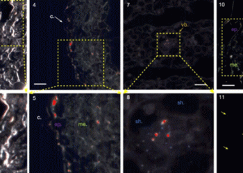 Invisible Contaminants: How Cabbage and Spinach Accumulate Microplastics in Their Leaves